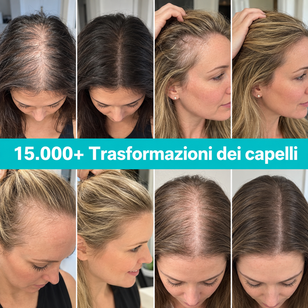 Velaia™ Siero per il cuoio capelluto con applicatore
