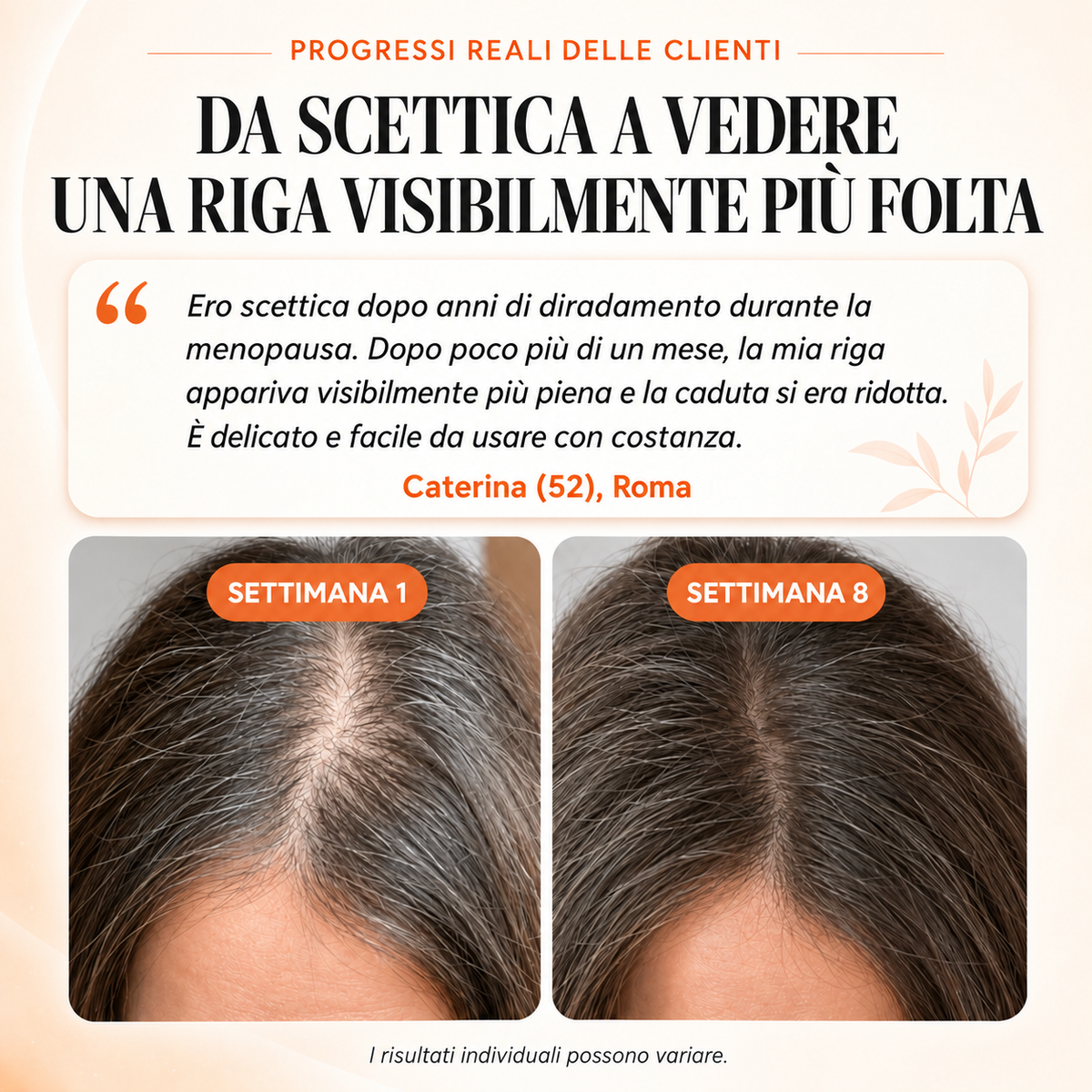 Velaia™ Siero per il cuoio capelluto con applicatore