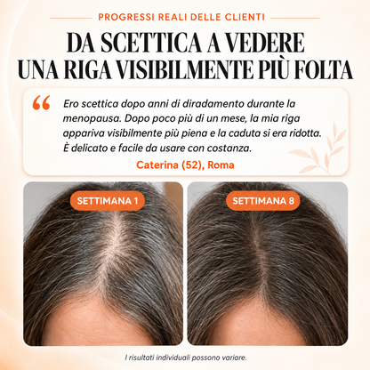 Velaia™ Siero per il cuoio capelluto con applicatore